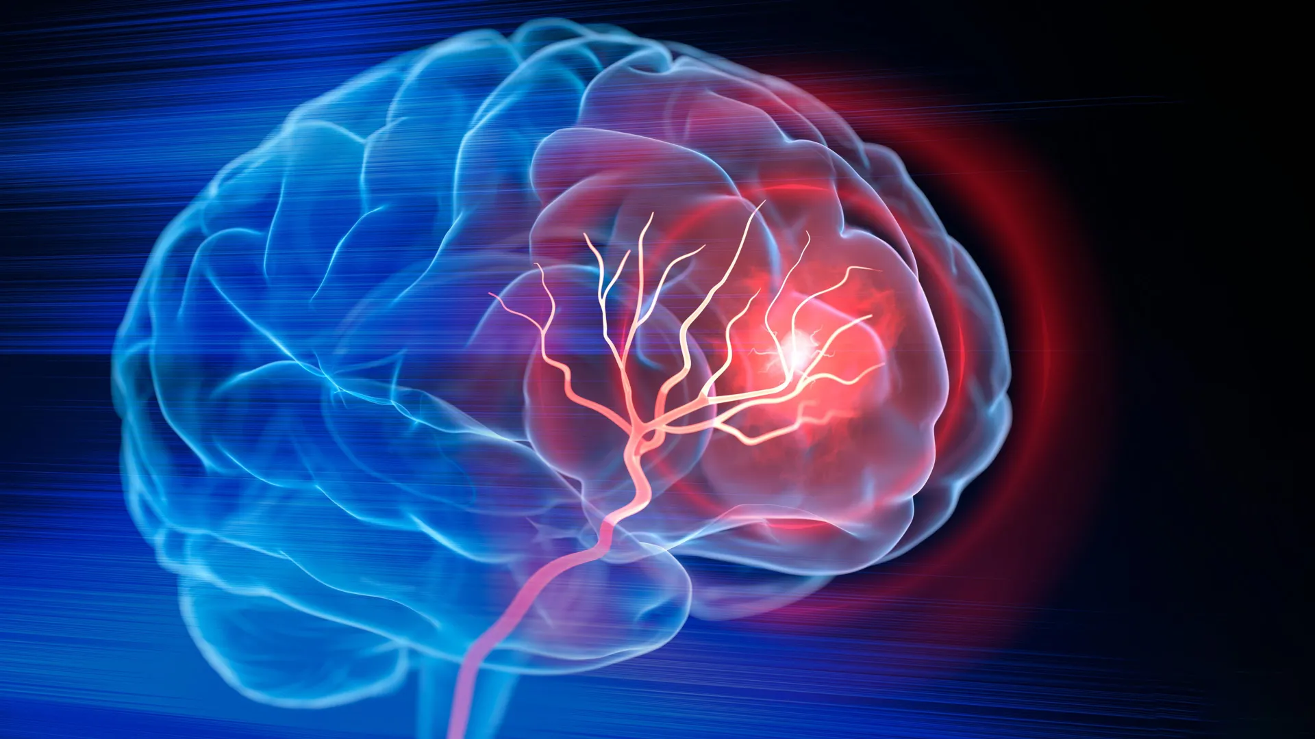 injectable-biomaterial-facilitates-neural-tissue-regeneration-and-functional-recovery-post-ischemic-stroke