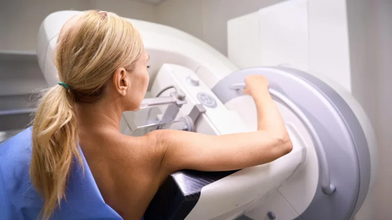 mammography-screenings-overstated-harms-new-analysis-reframes-overdiagnosis-concerns