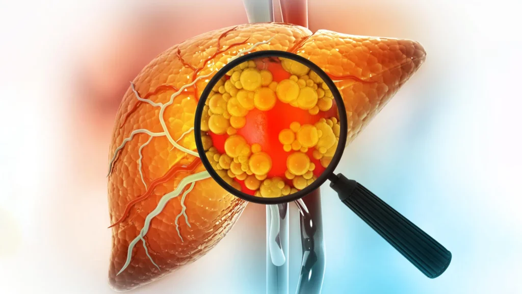 new-research-uncovers-unexpected-metabolic-pathways-for-sorbitol