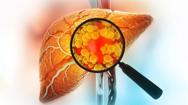 new-research-uncovers-unexpected-metabolic-pathways-for-sorbitol