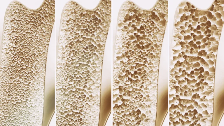 unlocking-bone-regeneration-scientists-pinpoint-gpr133-receptor-as-key-regulator-for-skeletal-strength