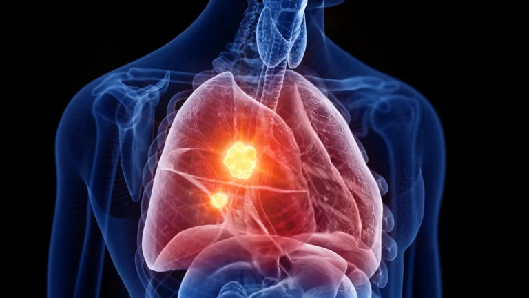 unlocking-new-therapeutic-avenues-rso-021-repurposes-cancers-own-protective-mechanisms-to-combat-mesothelioma