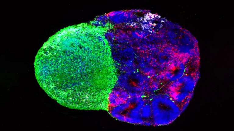 unraveling-the-blueprint-cellular-decision-making-orchestrates-human-brain-architecture
