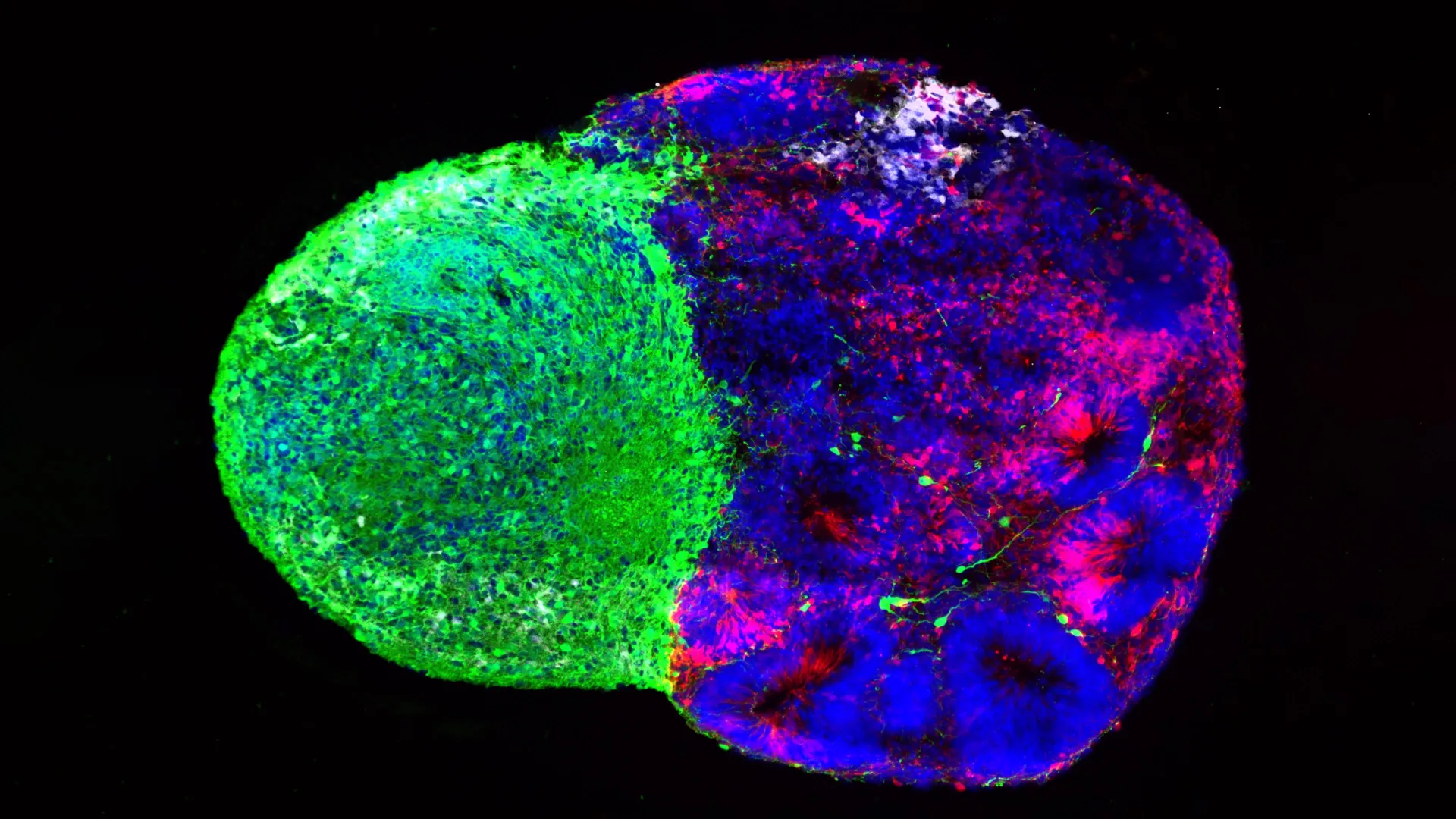 unraveling-the-blueprint-cellular-decision-making-orchestrates-human-brain-architecture