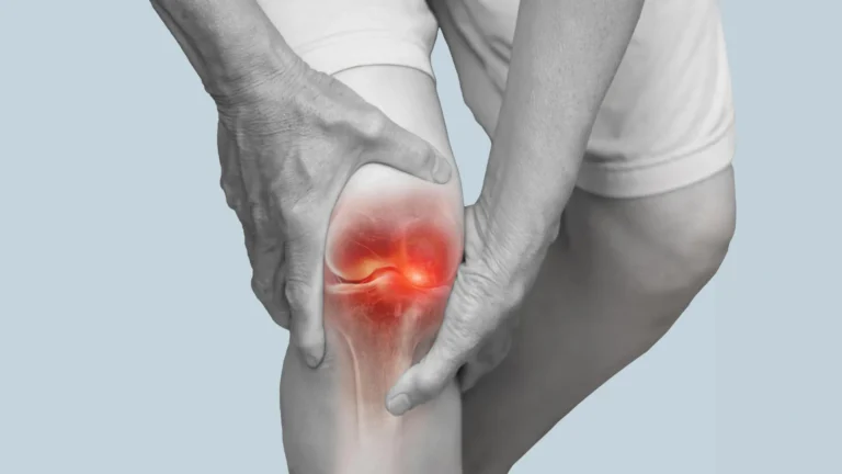 unveiling-top-non-pharmacological-strategies-for-osteoarthritis-knee-pain-management-based-on-extensive-patient-data