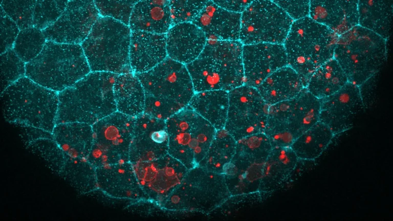 e-cadherin-a-foundational-proteins-unexpected-role-in-epithelial-debris-clearance-and-inflammation-management