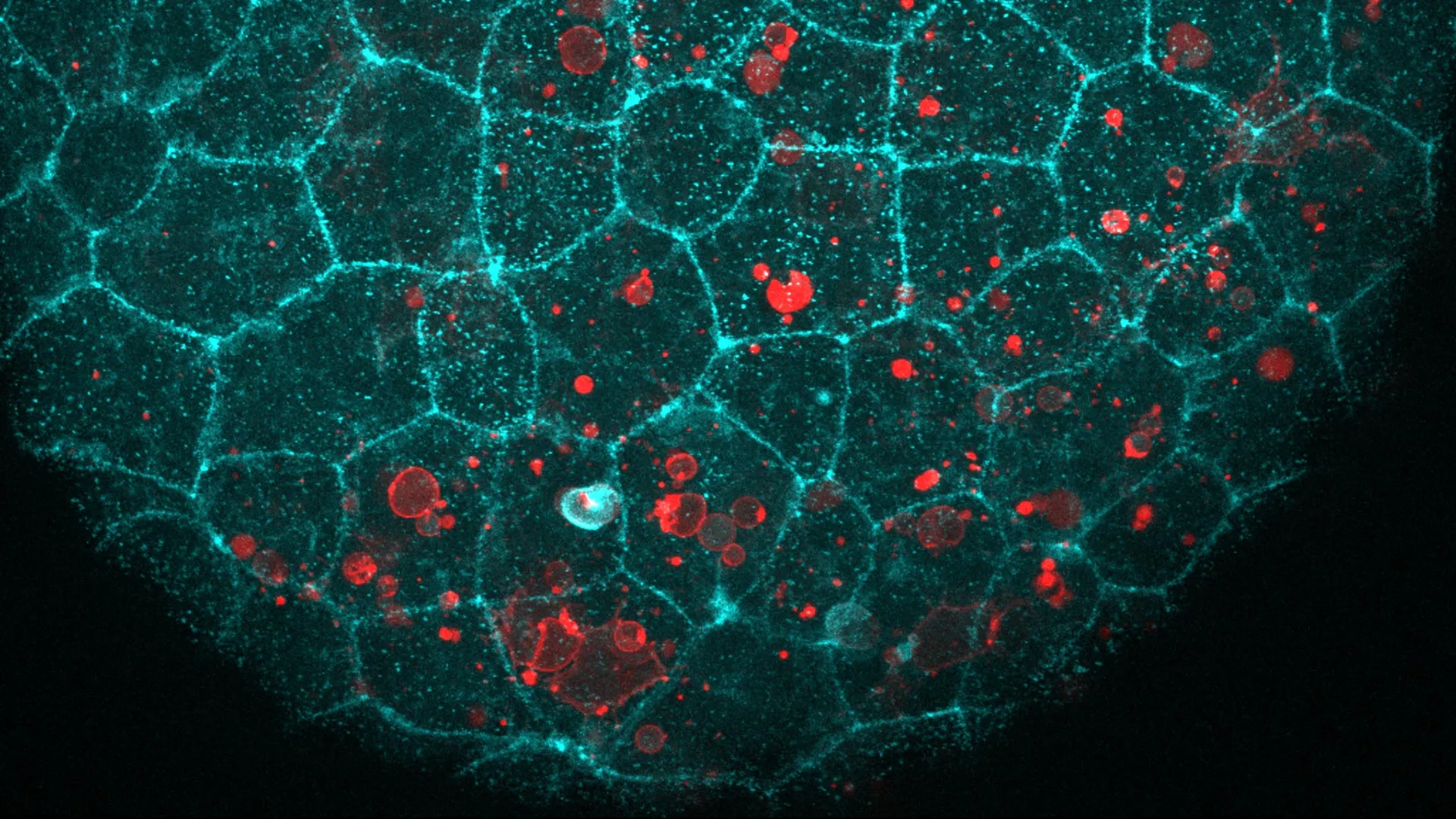 e-cadherin-a-foundational-proteins-unexpected-role-in-epithelial-debris-clearance-and-inflammation-management