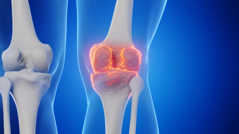 enzyme-inhibition-strategy-unveils-potential-for-articular-cartilage-repair-and-osteoarthritis-prevention