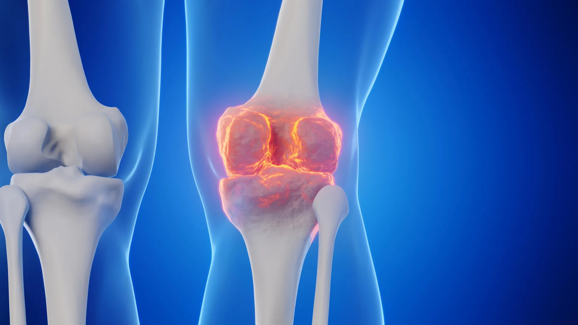 enzyme-inhibition-strategy-unveils-potential-for-articular-cartilage-repair-and-osteoarthritis-prevention